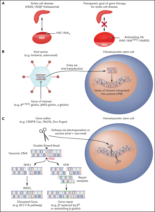 Gene therapy strategies for SCD. (A) Antisickling globin expression as a gene-therapy strategy to prevent RBC sickling. (B) Gene-addition strategy to deliver antisickling genes. (C) Gene-editing approaches to induce HbF by MHEJ and gene repair by HDR.