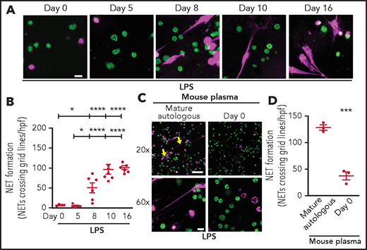 Neutrophils isolated from mouse pups fail to form NETs; a recapitulation of human peripartum NETosis inhibition. (A) NET formation in response to LPS stimulation (100 ng/mL; 1 hour) was detected in mouse PMNs isolated from C57BL/6 pups on days 0, 5, 8, 10, and 16 following birth. Confocal microscopy images of NET formation were obtained by using DNA stains, one that is cell permeable (SYTO Green, nuclear DNA, green) and the other that is cell impermeable (SYTOX Orange, NETs, magenta). Images are representative of 4 to 7 different experiments in PMNs isolated from 4 to 7 separate mouse pups per group. Scale bar, 10 μm. (B) A grid system was used to semiquantitatively assess NET formation. The y-axis depicts NET formation with NETs crossing standardized grid lines/high-power field (hpf) (± SEM). (C) Plasma “switch” experiments were performed, and NET formation was assessed by using PMNs isolated from mature mice ± a 1-hour pretreatment with day 0 mouse pup plasma. PMNs were then stimulated with LPS (100 ng/mL; 1 hour) and live cell imaging performed as in panel A. Images are representative of 3 different experiments in PMNs isolated from 3 separate mouse pups per group. Yellow arrows indicate NET formation. Scale bars, 50 μm (10 μm for the 20× and 60× magnification images, respectively). (D) A grid system was used to semiquantitatively assess NET formation. The y-axis depicts NET formation with NETs crossing standardized grid lines/hpf (± SEM) . *P < .05 and ****P < .0001 for comparison of day 8 and days 10 and 16 with day 0 and day 5, respectively; ***P < .001.