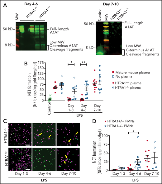 HTRA1 generates A1ATM383S-CF in vivo, which decreases early NET formation in neonatal mouse pups. (A) We tested plasma isolated from mouse pups, both HTRA1+/+ littermate controls and HTRA1−/−, for low-molecular-weight HTRA1 C-terminus cleavage fragments via western blotting between days 4 to 6 and 7 to 10 following birth. The western blots shown are representative of 3 separate experiments using 3 different mouse pups per group. (B) Plasma “switch” experiments were performed by using plasma isolated 1 to 3, 4 to 6, or 7 to 10 days following birth from both HTRA1+/+ (filled circles) and HTRA1−/− (open circles) mouse pups. Mature C57BL/6 mouse plasma served as a negative control (open and filled squares). We preincubated PMNs isolated from mature mouse bone marrow with mouse pup plasma or mature mouse control plasma for 1 hour before stimulation with LPS (100 ng/mL; 1 hour). NET formation was quantified by using a standardized grid system. The y-axis depicts NET formation with NETs crossing standardized grid lines/high-power field (hpf) ± SEM. We next isolated PMNs from mouse pups, both HTRA1+/+ (filled circles) and HTRA1−/− (open circles), at the indicated times and stimulated them with LPS (100 ng/mL; 1 hour). NET formation was assessed qualitatively via live cell imaging (C) and semiquantitatively by using a standardized grid system (D). Yellow arrows indicate NET formation. Images are representative of 3 to 12 separate experiments using between 3 and 12 different mouse pups per group. Scale bars, 50 μm. *P < .05, **P < .01. MW, molecular weight.