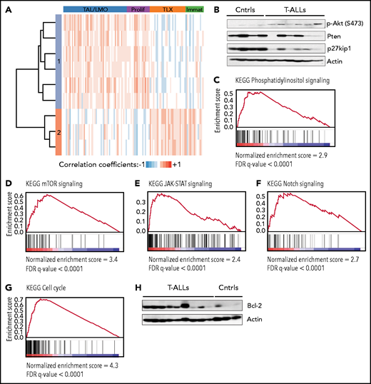 TetIL-7R tumors display hyperactivation of the PI3K/Akt pathway and mimic multiple features of human T-ALL. (A) Hierarchical clustering analysis of Pearson correlation coefficients between mouse tumors and human T-ALL. Each row corresponds to a mouse leukemia and each lane to a human T-ALL sample. Transcriptomic analyses showed that mouse tumors resemble either TAL/LMO+proliferative T-ALLs (cluster 1) or HOXA/TLX+immature (cluster 2), as defined in Homminga et al.31 Robustness of this analysis is shown by the fact that mouse leukemias that were “classified” as HOXA/TLX+immature–like display features of immature/ETP-ALL, such as higher KIT, CD33, and CD34 than the other tumors (supplemental Figure 4). (B) Akt activation (p-Akt), and PTEN and p27Kip1 expression levels were evaluated by immunoblot in On-dox F5 TetIL-7R thymic tumors (T-ALLs) vs control thymic samples from healthy, F5 mice (Ctrls). (C-G) GSEA of the ranked expression differences between tumors and controls for the KEGG pathways: phosphatidylinositol signaling (C), mTOR signaling (D), JAK-STAT signaling (E), Notch signaling (F), and cell cycle (G). (H) Bcl-2 expression levels were evaluated by immunoblot in tumors and controls. KEGG, Kyoto Encyclopedia of Genes and Genomes.