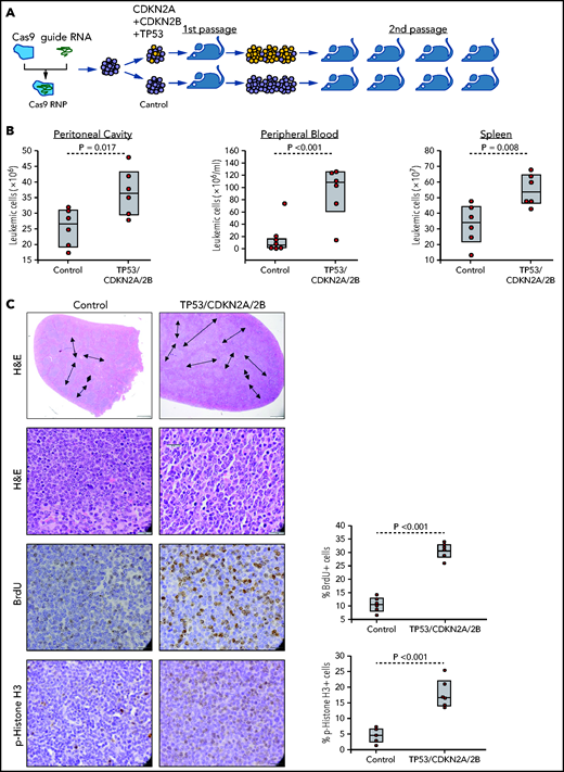 Combined CDKN2A, CDKN2B, and TP53 disruption accelerates tumor growth in the Eμ-TCL1 adoptive transfer model. (A) Schematic representation of the CRISPR/Cas9 procedure to target the CDKN2A, CDKN2B, and TP53 genes in primary Eμ-TCL1–derived murine CLL cells. (B) Box plots with data points showing absolute numbers of CD5+/CD19+ leukemia cells in peritoneal cavity, peripheral blood, and spleen of mice at 21 days after receiving CDKN2A/2B/TP53-targeted or control leukemia cells (n = 6 mice per group). Statistical analysis was performed using the Student t test. (C) Hematoxylin-and-eosin (H&E) staining and immunohistochemistry analysis of proliferating BrdU+ and phosphohistone H3+ cells in spleens of mice 21 days after receiving CDKN2A/2B/TP53-targeted or control leukemia cells. Images were captured with an Olympus BX53 microscope using an Olympus UC90 camera and CellSens Entry software. Statistical analysis was performed using the Student t test. Top row: scale bars, 500 μm; rows 2-4: scale bars, 20 μm. (D) Indel analysis by amplicon capillary electrophoresis of CDKN2A/2B/TP53-targeted leukemia cells isolated from spleens of mice after the first and second passage. Wild-type alleles are indicated by a red arrow; mutant alleles are indicated by a black arrow or brackets. The mutant/wild-type (M/WT) ratio was calculated by dividing the sum of the peak areas of the mutant alleles with the peak area of the wild-type allele. (E) Amplicon capillary electrophoresis analysis of indels in CDKN2A, CDKN2B, and TP53 in leukemia cells with independent targeting of CDKN2A/2B or TP53. (F) Box plots with data points showing absolute numbers of CD5+/CD19+ leukemia cells in peritoneal cavity, peripheral blood, and spleen of mice injected with CDKN2A/2B-targeted, TP53-targeted, or control leukemia cells (n = 8 mice per group).