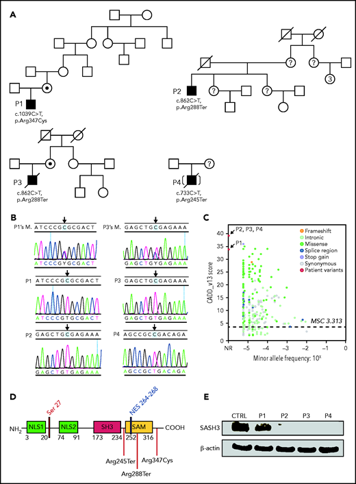 Pedigrees, SASH3 genetic variants, and protein expression. (A) Pedigrees and familial segregation of mutant SASH3 alleles. Probands are indicated as P1to P4. SASH3 variants detected by whole-exome sequencing are designated at the nucleotide and amino acid level below each patient. (B) Sanger sequencing confirmation of SASH3 variants. The patient is identified on the upper left of each chromatogram (M., mother). Arrows designate the mutated nucleotide. Parental sequencing was not obtained for P2 or for P4 who was adopted. (C) SASH3 variants are predicted to be damaging. Plot of combined annotation depletion dependent (CADD, version 13) score vs minor allele frequency (MAF) of SASH3 modified from PopViz (Rockefeller University, New York, NY). The dotted horizontal line corresponds to the SASH3 mutation significance cutoff (MSC) score. Arrows identify the CADD score of each of the SASH3 variants detected in the patients, all of which were private (MAF = 0). (D) Schematic representation of the SASH3 protein and its domains. Locations of the patients’ variants are indicated by vertical red lines. Numbers indicate amino acid positions. (E) SASH3 protein is not detectable in patients with nonsense SASH3 variants. The immunoblot shows results for SASH3 and β-actin protein expression in PBMC lysates for the patients identified above each lane. CTRL, control, NES, nuclear export signal; NLS1, nuclear localization signal 1; NLS2, nuclear localization signal 2; NR, not reported.