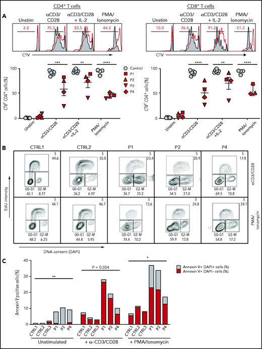 Proliferation, cell cycle, and apoptosis of SASH3-mutated T cells after in vitro stimulation with mitogens. (A) Top: Representative plots showing Cell Trace Violet (CTV) staining in CD4+ or CD8+ T cells from P2 (red line) and control (solid gray). Red numbers correspond to the frequency of CTVlow proliferating cells (black bar). Bottom: Cumulative percentage of CTVlow cells among CD4+ or CD8+ T cells from controls (solid gray) or SASH3-mutated patients (red) in resting conditions or upon stimulation with anti-CD3 and anti-CD28, anti-CD3 and anti-CD28 plus IL-2, or PMA and ionomycin. Response to PMA and ionomycin was not studied in P3 because of a lack of available cells. Bars represent mean values ± standard error of the mean. (B) Cell cycle analysis. PBMCs from controls (CTRL1 and CRTL2) and patients (P1, P2, P4) were stimulated with anti-CD3 and anti-CD28 for 96 hours, or with PMA and ionomycin for 72 hours and then stained with 5-ethynyl-2′-deoxyuridine (EdU) and DAPI. A decreased proportion of cells in S phase and an accumulation of cells in G2/M phase were observed in the patients. (C) Analysis of cell apoptosis. PBMCs from controls (CTRL1 to CTRL3) and patients (P1, P2, P4) were either left unstimulated or were cultured with anti-CD3 and anti-CD28 or PMA and ionomycin for 96 hours and stained with annexin V and DAPI for 30 minutes; live cells were counted by flow cytometry. P3 was not studied because of lack of available cells. Increased apoptosis was observed in all patient samples when compared with controls. Statistical analysis was performed by comparing the percentage of annexin V+ cells in patients vs controls. *P ≤ .05; **P ≤ .01; ***P ≤ .001; ****P ≤ .0001.