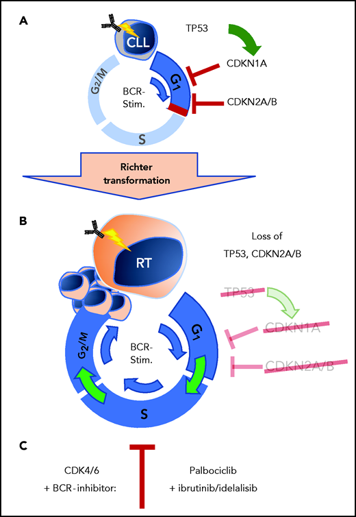 Loss of cell-cycle control in RT from CLL cells. (A) Cell-cycle control by TP53, CDKN1A, CDKN2A, and CDKN2B blocks proliferation in CLL stage B cells after BCR stimulation. (B) Loss of TP53 and CDKN2A/B in RT allows transformed cells to proliferate past inactivated cell-cycle checkpoints. (C) Combined BCR- and CDK4/6-inhibition provides effective therapeutic response in preclinical RT mouse models. BCR-stim., BCR stimulation.