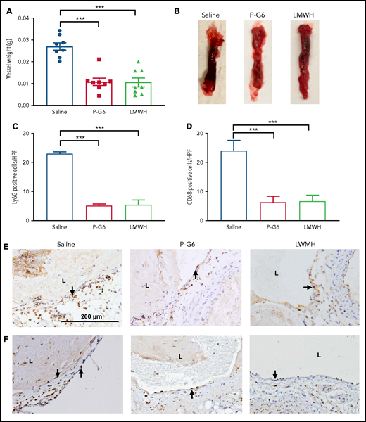 Treatment with P-G6 reduces venous thrombus formation. A nonocclusive thrombus was induced be electrolytic injury of the inferior vena cava, and vessel thrombus weight was measured 48 hours after injury to determine treatment efficacy. (A) Prophylactic administration of P-G6 (8 µmol/kg IV) and low molecular weight heparin (LMWH; 6 mg/kg, subcutaneously) resulted in a significant reduction in thrombus weight compared with mice administered saline vehicle (8 mice per group). (B) Representative images of excised infrarenal vena cava 48 hours after electrolytic injury. (C-F) Neutrophil and macrophage infiltration within the vein wall 48 hours after thrombus induction. Quantification of Ly6G+ neutrophils (C,E) and CD68+ macrophages (D,F) reveals significantly less wall inflammation compared with mice administered saline vehicle. Arrows indicate positive immunostaining scale bar displayed in saline group applies to all images. Data are mean ± SEM. ***P < .001, ANOVA with Tukey’s multiple-comparison test. L, lumen.