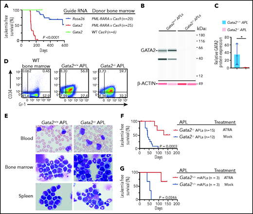 Gata2 acts as a tumor suppressor in mouse APL. (A) Leukemia-free survival of recipient Ly5.1 mice transplanted with nonleukemic lineage-depleted PML-RARA × Cas9 bone marrow in which Rosa26 intron 1 or Gata2 exon 2 was targeted with CRISPR guide RNAs prior to transplantation (n = 20 mice in Rosa26 group from 2 cohorts of 10 mice per cohort; n = 25 mice in Gata2-targeted PML-RARA × Cas9 bone marrow group from 3 cohorts of 5 to 10 mice per cohort; n = 6 mice in Gata2-targeted WT Cas9 bone marrow group from 1 cohort of mice). P < .0001, log-rank (Mantel-Cox) test. (B) Protein expression, detected using a Jess by ProteinSimple apparatus, of GATA2 and β-ACTIN from the bone marrow of Gata2-sufficient (Gata2+/+) or Gata2-targeted (Gata2−/−) Ctsg-PML-RARA APL mice. Blots for GATA2 and β-ACTIN were performed on the same samples using 2 antibodies in 2 spectral channels: chemiluminescence (GATA2) and near infrared (β-ACTIN). Data are representative of 3 or 4 independent biological replicates per genotype. (C) Quantification of the relative GATA2/β-ACTIN protein expression from the bone marrow of Gata2+/+ or Gata2−/−Ctsg-PML-RARA APL mice. Data are from 3 or 4 independent biological replicates per genotype. (D) CD34 and Gr-1 expression by flow cytometry on bone marrow from 8- to 12-week-old WT mice, Gata2+/+Ctsg-PML-RARA APL spleen cells, and Gata2−/−Ctsg-PML-RARA APL spleen cells. Data are representative of 3 or 4 independent biological replicates. (E) Wright-Giemsa staining of blood, bone marrow, and spleen from Gata2+/+ (Rosa26-targeted) or Gata2−/− (Gata2-targeted) Ctsg-PML-RARA APL mice. Images are representative of 5 to 8 independent biological replicates for each genotype. Images were captured using an Olympus BX-53 microscope and an Olympus DP-72 camera (original magnification ×100). (F) Leukemia-free survival of recipient Ly5.1 mice transplanted with fully transformed Gata2−/−Ctsg-PML-RARA APL spleen cells and then treated with surgically implanted ATRA pellets (black lines) or control pellets (Mock; red lines). N = 12 control-treated mice; N = 15 ATRA-treated mice. Gata2−/− APLs were derived from 3 biologically independent mice. P = .0003, log-rank (Mantel-Cox) test. (G) Leukemia-free survival of recipient Ly5.1 mice transplanted with Gata2+/+Ctsg-PML-RARA APL spleen cells and then treated with surgically implanted ATRA pellets (black lines) or control pellets (Mock; blue lines). N = 3 control-treated mice, N = 3 ATRA-treated mice. Gata2+/+ APLs were derived from 1 mouse. P = .0246, log-rank (Mantel-Cox) test.
