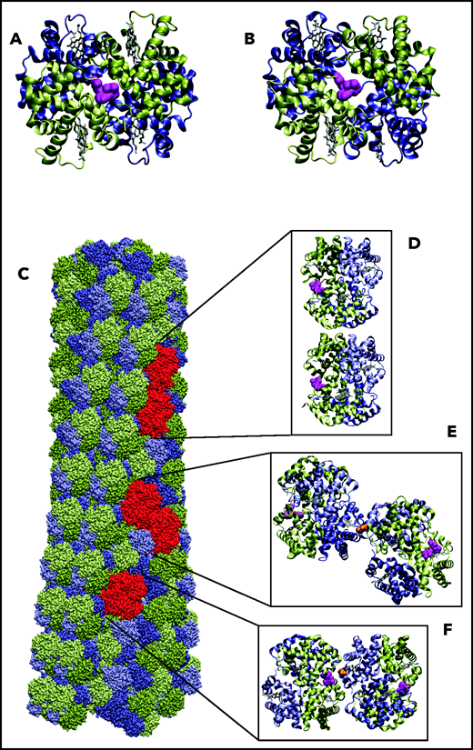 Location of voxelotor in sickle fiber. (A) The X-ray structure of voxelotor bound to the R conformation of Hb shows that the drug is located in a complementary pocket between α chains (green) of the structure (Protein Database; PDB 5E83),56,57 and (B) when modeled using the same conformation as in R, it can easily fit into the pocket of the deoxyHbS structure (T conformation) (PDB 2HBS).58 Hb is shown in a ribbon representation and drug in a magenta, space-filling representation. (C) The HbS fiber structure model is shown in a space-filling representation. It consists of 14 strands, which can be grouped into 7 twinned (doubled) strands59 bridged by axial (D) and lateral (E) contacts, similar to those in the T crystal structure illustrated. The drug is located far from both the canonical axial and equatorial interfaces between Hb tetramers in the twinned strands. It is, however, closer to other possible contacts present in the fiber. Beta6 valine is the orange molecule in panels E and F. (F) The closest approach of the drug to a neighboring tetramer, in which the nearest heavy atom distance between drug and neighbor is still 7.6 Å. Thus, there appear to be no interfaces in the fiber where voxelotor would directly interfere with polymerization.