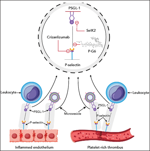 P-selectin on activated endothelium and on activated platelets binds PSGL-1 on leukocytes and leukocyte microvesicles. Crizanlizumab and P-G6 target P-selectin, and SelK2 targets PSGL-1.
