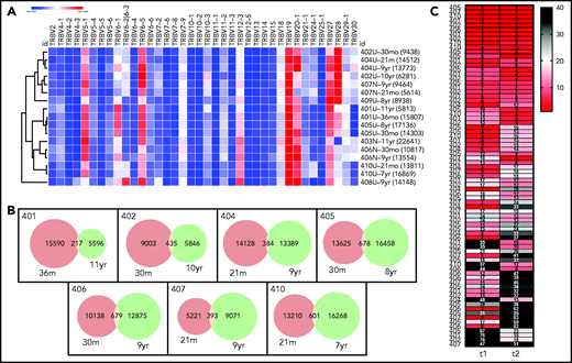Stability of T-cell repertoires in transplanted patients. (A) TRBV gene use, normalized (heat map indicates z-score) and clustered by row (sample). Each clone is only counted once per sample. TRBV genes that account for <1% of total clones are excluded. Each row is labeled with the sample name and time point and the clone number is given in parentheses. (B) Venn diagrams showing clone numbers that are found at each time point and those that overlap between 2 time points (based on the same samples and time points that are shown in panel A). (C) Ranks of the T-cell clones that overlap between the 2 time points. Numbers to the left indicate the subjects. Columns indicate the time of the sample, with time point 1 (t1) being the earlier time point and t2 the later time point (same samples and time points as in panel A. Numbers in the cells indicate the clone ranks, which are also shown in the heat map. A rank of 1 indicates the clone with the highest sequence copy number fraction in the sample. Only clones with a combined rank of <100 (summed ranks of t1 + t2) are shown.