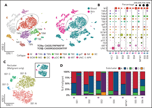 ECCITE-seq captures transcriptional, surface protein and clonotypic information from multiplexed healthy and CTCL tissues as well as malignant heterogeneity in disease. (A) Representative t-SNE plots of single cells from PBMCs and skin dissociated tissue of a CTCL patient (SS1) clustered and visualized by GEX and ADT expression using WNN analysis and colored by cluster (left) or tissue of origin (right). (B) Dot plot showing the percentage of populations making up the skin and blood of a healthy control (HC1), 5 CTCL patients (SS1-MF stage IV1), and blood from 2 CTCL patients (SS6 and SS7). Apoptotic keratinocytes from skin tissue were filtered out. (C) Representative t-SNE plot depicting transcriptional heterogeneity within the malignant T cells from matched blood and skin defined by their common expanded clonotype in a CTCL patient. (D) Bar plots showing the subclonal composition based on transcriptional differences in malignant T cells from 7 CTCL patients (5 of whom have matched blood and skin). APK, apoptotic keratinocytes; BC, B cells; BCM, memory B cells; DC, dendritic cells; FB, fibroblasts; gdT, γ/δ T cells; KRT, keratinocytes; M, malignant T cells; MO, monocytes/macrophages; NK, natural killer cells; pDC, plasmacytoid dendritic cells; T4M, memory CD4+ T cells; T4N, naïve CD4+ T cells; T8E, effector CD8+ T cells; T8M, memory CD8+ T cells; T8N, naïve CD8+ T cells; UNC, unclassified.