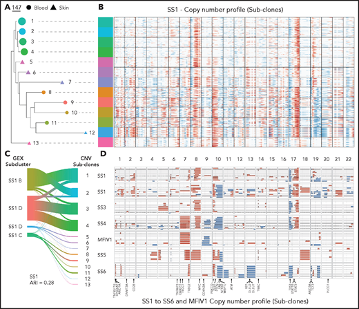 Copy number variations (CNVs) identify distinct malignant subclones phylogenetically intermixed between CTCL tissues. (A) Subclonal populations are colored based on inferred CNV analysis . Predicted regions of copy number gain (in red) or loss (in blue) highlighted across the genomic position (columns) and single cells (rows) divided into their subclonal branches from phylogenetic analysis.(B) Plot showing gain (in red) and loss (in blue) events in CNV defined subclones from the skin- and blood-derived clonal malignant T cells from 5 patients (SS1-MF stage IV1) and blood from 2 patients (SS6 and SS7). Skin derived CNV states are shown as dashed lines and blood derived CNV states as solid lines. CNV states with less than 1% frequency in their tissue or based on less than 5 cells were filtered out. (C) Representative phylogram of the malignant skin- and blood-derived T cells of a CTCL patient (SS1) bootstrapped 100 times and rooted using their non-malignant polyclonal T cells to determine malignant evolution of CNV defined clusters. Branch length depicts level of CNV burden. (D) Representative river plot showing connections between GEX based malignant subclusters and CNV defined malignant subclones in a CTCL patient (SS1).
