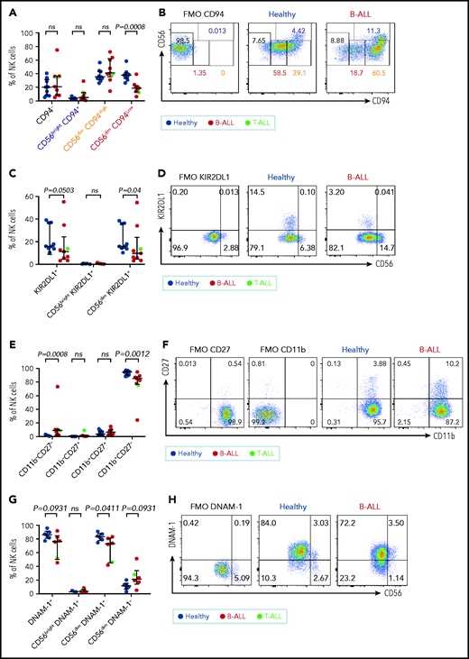 Maturation of NK cells into cytotoxic effectors is perturbed in PBMCs from patients with B/T-ALL. Flow cytometry analysis of NK cells showing the percentages of CD94−, CD56brightCD94+, CD56dimCD94High, and CD56dimCD94Low NK cells (A-B), KIR2DL1+ total NK cells and CD56brightKIR2DL1+ and CD56dimKIR2DL1+ NK cells (C-D), CD11b−CD27−, CD11b−CD27+, CD11b+CD27+, and CD11b+CD27− NK cells (E-F) in PBMCs from healthy donors (n = 9) and B/T-ALL patients (n = 9). (G-H) Flow cytometry analysis of NK cells showing the percentages of DNAM-1+ total NK cells and CD56brightDNAM-1+, CD56dimDNAM-1+, and CD56dimDNAM-1−NK cells in PBMCs from healthy donors (n = 6) and B/T-ALL patients (n = 6). Graphs show median ± interquartile range. Gates for each marker were set using fluorescence − 1 (FMO) controls. Exact P values were calculated using the Mann-Whitney U test. ns, nonsignificant.