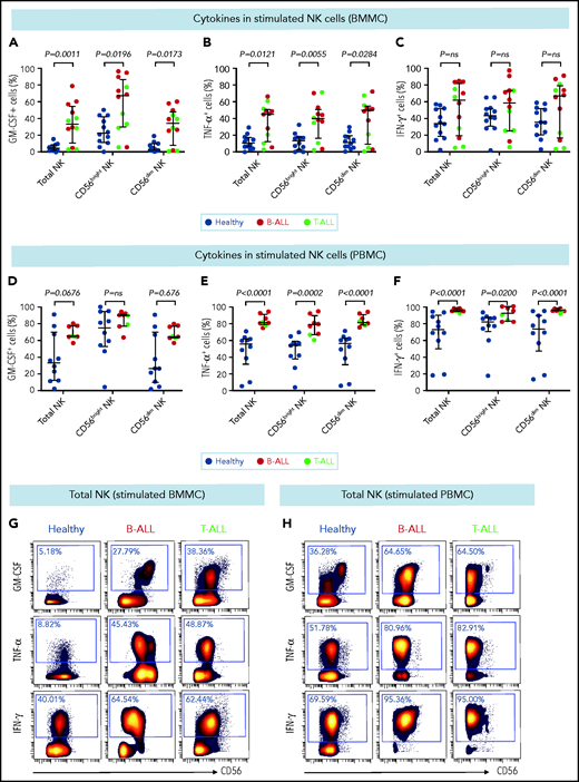 Stimulated NK cells in patients with B/T-ALL produce more cytokines than do their healthy counterparts. CyTOF analysis of the frequencies of PMA+ionomycin-stimulated NK cell subsets expressing GM-CSF (A), TNF-α (B), and IFN-γ (C) in BMMCs from healthy donors (n = 12) and patients with B/T-ALL (n = 12). CyTOF analysis of the frequencies of PMA+ionomycin-stimulated NK cell subsets expressing GM-CSF (D), TNF-α (E), and IFN-γ (F) in PBMCs from healthy donors (n = 10) and patients with B/T-ALL (n = 8). Representative dot plots showing the expression of GM-CSF, TNF-α, and IFN-γ in PMA+ionomycin-stimulated NK cells in BMMCs (G) and PBMCs (H) from ALL patients and healthy donors. Graphs show median ± interquartile range. Exact Pvalues were calculated using the Mann-Whitney U test. ns, not significant.