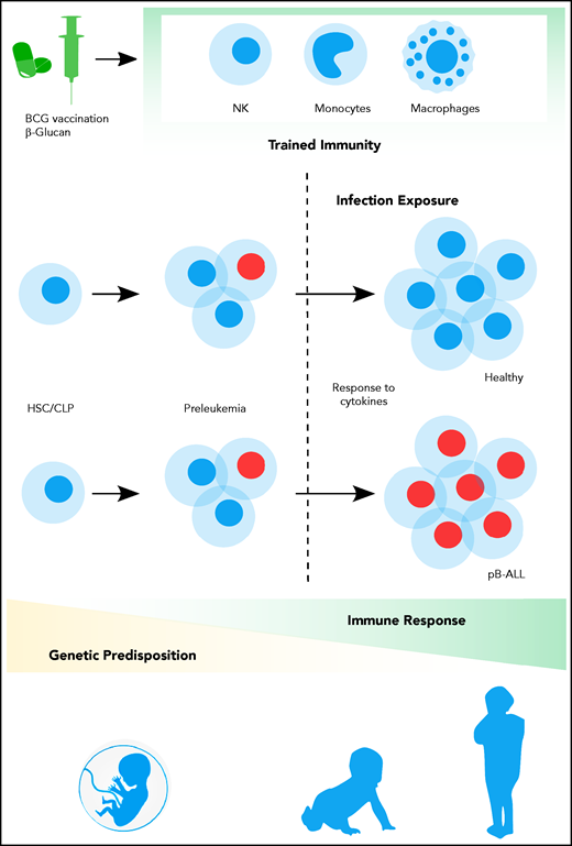 Contribution of trained immune responses to BCP-ALL development. Children genetically predisposed to BCP-ALL harbor clonally expanded preleukemic cells at birth. A hematopoietic stressor, such as infection, has the potential to trigger ALL at a later time point (2-6 years). The genetically determined immune responses, cytokine release, and basal cytokine levels, especially of interferons, may influence the outgrowth of the leukemic clone. However, the role of earlier-trained innate cells in the control of the preleukemic clone is largely unappreciated thus far. Epidemiological and experimental data suggest that innate immunity can be trained by BCG vaccination or β-glucan application, which substantially reduces the risk of developing BCP-ALL.