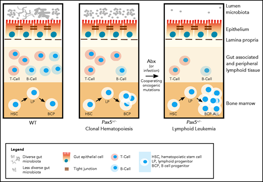 Antibiotic treatment in the development of lymphoblastic leukemia. Antibiotic treatment in early life induces leukemia in genetically predisposed Pax5+/− mice.81 (Left) In wild-type mice, depletion of the gut microbiome bacteria by antibiotic treatment at 8 weeks of age has only a transient effect on the immune system (including the gut-associated and peripheral lymphoid tissues) and mice do not develop pB-ALL. (Right) Pax5 heterozygosity directly affects B-cell maturation and leads to clonal hematopoiesis, while also indirectly reducing gut microbiota diversity. In response to bacterial depletion in the gut microbiome by antibiotic treatment at 8 weeks of age, the microbiome reconstitutes with further reduced diversity. Cooperating oncogenic mutations then lead to pB-ALL in ∼50% of these mice between 11 and 21 months of age. Leukemia development is preceded by a reduction of mature B and T cells in the gut and associated peripheral lymphoid tissues. However, it has not been tested in this model whether leukemia development can be inhibited through intervention. In addition to microbial dysbiosis, infectious stimuli can also cooperate with oncogenic mutations, leading to leukemia development in Pax5+/− mice.31