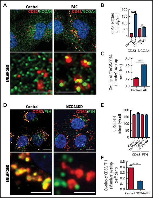 Iron repletion leads to the colocalization of CD63 and NCOA4 into the same vesicle. (A) IMR90SV cells were incubated in medium (–FBS) (control) or medium supplemented with FAC (10 µg/mL) for 16 hours at 37°C. Cells were fixed and stained with anti-NCOA4 (green) and anti-CD63 (red) antibodies. (B) Quantification of CD63 and NCOA4 intensity in panel A. (C) Quantification of CD63 and NCOA4 colocalization indicated by Manders’ overlap coefficient. (D) Control and NCOA4KD IMR90SV cells were incubated for 16 hours at 37°C with 10 µg/mL FAC. Cells were fixed and stained with anti-FTH (green) and anti-CD63 (red) antibodies. (E) Quantification of CD63 and NCOA4 intensity in panel D. (F) Quantification of CD63 and FTH colocalization by Manders’ overlap coefficient. (A,D) Thin scale bar, 10 µm; thick scale bar, 2.5 µm. For analysis, >60 cells were examined per condition over 3 experiments. Results are mean ± SEM (3 experiments). Significance was determined using the Student t test. **P < .01; ****P < .0001.