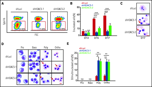Impaired enucleation and generation of abnormal nuclei after HDAC5 knockdown. (A) Representative profiles of enucleation as assessed by SYTO 16 staining on day 17 of culture. The enucleation percentage was calculated as the SYTO 16–negative cells in the total population. (B) Quantitative analysis of enucleation on the indicated days from 3 independent experiments. (C-D) Representative cytospin images of day 17 erythroblasts (C). Representative cytospin images of sorted distinct stages of erythroblasts (D). Red arrows indicate binucleated and multinucleated erythroblasts. Scale br, 10 μm. (E) Quantification of binucleated and multinucleated erythroblasts in sorted erythroblasts at the different developmental stages. (B, E) *P < .05; **P < .01; ***P < .001. Baso, basophilic erythroblasts; Ortho, orthochromatic erythroblasts; Poly, poly chromatic erythroblasts; Pro, proerythroblasts.