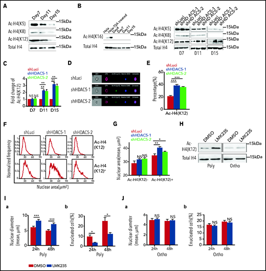 Histone 4 acetylation and chromatin condensation. (A) Representative western blots showing changes in histone H4 acetylation (AC-H4) during terminal erythroid differentiation. (B) Representative western blots showing effects of HDAC5 knockdown on H4 acetylation on K5, K8, K12, and K16. (C) Quantitative analysis of H4K12 acetylation levels from 3 independent experiments. (D) Representative ImageStream images of day 17 erythroblasts stained with anti-H4K12, GPA, and Hoechst 33342. (E) Quantitative analysis of H4K12+ erythroblasts. (F) Representative nuclear area profiles of H4K12+ and H4K12− erythroblasts from ImageStream analysis. (G) Quantitative analysis of nuclear area of H4K12+ and H4K12− erythroblasts from 3 different experiments. (H) Effect of LMK235 on H4K12 acetylation in polychromatic and orthochromatic erythroblasts. (I) Effect of LMK235 on chromatin condensation (a) and enucleation (b) of polychromatic erythroblasts. (J) Effect of LMK235 on chromatin condensation (a) and enucleation (b) of orthochromatic erythroblasts. *P < .05; **P < .01; ***P < .001. NS, nonsignificant. Ortho, orthochromatic erythroblasts; Poly, poly chromatic erythroblasts.