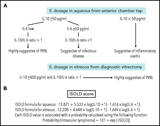 Interleukin levels in case of clinical suspicion of PVRL. (A) IL-10 and IL-6 levels in the aqueous humor and vitreous for PVRL screening and diagnosis. In the aqueous humor, an absolute level of IL-10 ≥50 pg/mL and IL-10/IL-6 ratio >1 is suggestive of PVRL (IL-10 cutoff: sensitivity, 89%; specificity, 93%). In patients with uveitis, the level of IL-10 is low and IL-10/IL-6 ratio is <1. In patients with an infectious disease, the IL-10 level might exceed 50 pg/mL, but the IL-6 level might also be >50 pg/mL; the IL-10/IL-6 ratio is <1. In the vitreous, the absolute level of IL-10 ≥400 pg/mL and IL-10/IL-6 ratio >1 are also suggestive of PVRL (IL-10 cutoff: sensitivity, 80%; specificity, 99%). Data adapted.12,100 (B) The Interleukin Score for Intraocular Lymphoma Diagnosis (ISOLD) is a probability score for the diagnosis of PVRL based on a mathematical formula combining both IL-10 and IL-6 levels in vitreous or aqueous samples with high sensitivity and specificity (93% and 95%, respectively). Data adapted.37