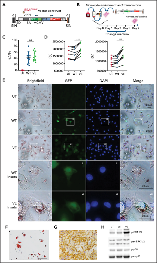 Macrophages expressing BRAFV600E recapitulate the pathologic phenotype of ECD. (A) Schematic representation of the lentiviral vector expressing BRAFV600E. (B) Experimental set up: monocytes isolated from the buffy coats of healthy donors were transduced with lentiviral constructs and cultured for 7 days before harvesting and analysis. (C) Expression level of wtBRAF (WT) and BRAFV600E (VE) as determined by GFP in flow cytometry; 10 independent donors are shown, with statistical significance evaluated with Friedman test with Dunn’s multiple-comparisons test; ns nonsignificant. (D) Flow cytometric analysis of forward and side scatter rates (FSC and SSC, respectively) of nontransduced macrophages (UT) or macrophages expressing wtBRAF (WT) and BRAFV600E (VE); 7 independent donors are shown, with statistical significance evaluated with Friedman test with Dunn’s multiple-comparisons test. ***P < .01. (E) Representative widefield images of staining with Oil Red O of nontransduced macrophages (UT) or macrophages expressing wtBRAF (WT) and BRAFV600E (VE). Cells were fixed, stained with DAPI and Oil Red O solution, and analyzed by widefield fluorescence microscopy to observe wtBRAF and BRAFV600E expression level (as determined by GFP detection), DAPI-stained nuclei, and Oil Red-O staining. Scale bars, 20 μm. (F) Oil Red-O staining of primary macrophages isolated from an ECD lesion (skin biopsy specimen, original magnification x400). Scale bar, 100 μm. (G) Immunohistochemistry staining showing phosphorylated ERK in macrophages infiltrating ECD lesions (skin biopsy specimen). (H) Western blot analysis of phosphorylated ERK1/2 (p-ERK1/2) and phosphorylated p38 (p-p38) in nontransduced macrophages (UT) or macrophages expressing wtBRAF (WT) and BRAFV600E (VE). The levels of total ERK1/2 and total p38 in whole-cell lysates were used as the protein loading control.