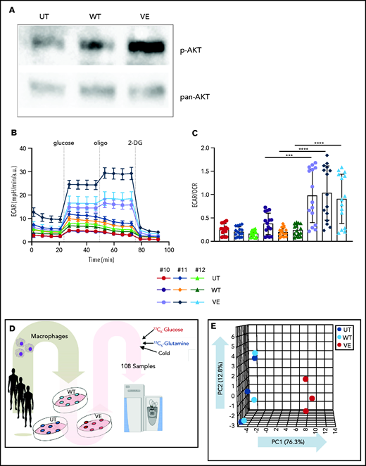 Immunometabolic changes indicative of TI in macrophages expressing BRAFV600E. (A) Western blot determination of phosphorylated AKT (p-AKT). The levels of total AKT in whole-cell lysates were used as the protein-loading control. (B) Analysis of ECAR measurements on primary human monocytes isolated from healthy volunteers in 3 different conditions, nontransduced (UT), transduced with wtBRAF (WT) or BRAFV600E (VE), in basal conditions and after sequential addition of glucose, oligomycin, and 2-DG. (C) Relative ECAR to oxygen consumption rate ratio (right). ***P < .001; ****P < .0001, unpaired Student t test. (D) Summary of metabolomics studies: primary human monocytes isolated from 3 healthy volunteers were cultured in 3 different conditions: nontransduced (UT, isolated primary monocytes), transduced with wtBRAF (WT), and transduced with BRAFV600E (VE). Cells were cultured in RPMI-1640+FBS only (Cold) or RPMI-1640+FBS with the addition of 13C6-glucose labeled glucose or 13C5-glutamine for tracing experiments. (E) Principal component analysis (PCA) of high-throughput metabolomics analysis on cold samples showing separation of experimental conditions along the component 1 axis (76.3%); interindividual variability is described by the component 2 axis (12.8%). (F) Hierarchical clustering analysis of the top 50 significant metabolites (Student t test) is represented as a heat map grouped by pathways that are known to be relevant to TI. (G) Overview of the glycolysis pathway in tracing experiments with U-13C6-glucose. (H) Overview of the TCA pathway in tracing experiments with 13C5-glutamine. (I) Incorporation of carbons in de novo synthesized cholesterol: carbon molecules deriving from either labeled glucose (red) or labeled glutamine (blue) are expressed as a percentage of the total. (J) Hematoxylin and eosin stain of ECD lesion (skin biopsy specimen, original magnification x200). (G-I) *P < .05; **P < .01; ***P < .001; ****P < .0001; ns, nonsignificant. Statistical significance of differences was evaluated with ANOVA. FBS, fetal bovine serum.