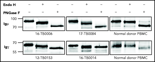 N-linked mannoses in the antigen-binding site of GCB-DLBCL are susceptible to treatment with Endo H. The glycosylation patterns of GCB-DLBCL primary samples (known to have AGSs in the CDRs) and peripheral blood mononuclear cells (PBMCs) from healthy donors were analyzed by digestion with Endo H (which cleaves mannose only) or PNGase F (which removes all glycans) after biotinylation and isolation of the cell surface proteins. Primary anti-µ or anti-γ antibodies were used to detect the surface Igµ (16-TB0006 and 17-TB0084 primary samples) or Igγ heavy chains (12-TB0153 and 16-TB0014) by immunoblotting, respectively. Numbers on the left of each gel indicate the molecular weight in kD of the reference ladder. The characteristics of the primary samples are described in supplemental Table 6. The glycosylation pattern of DLBCL cell lines with or without AGS in the CDR is shown in supplemental Figure 4.