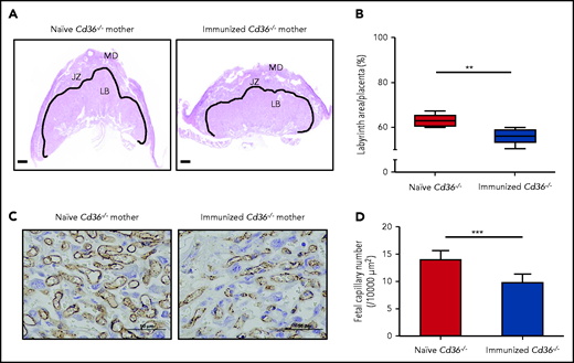 Anti-CD36 antibodies impaired vascularization in the immunized Cd36−/− mice placenta labyrinth zone. Additional 3 naive or Cd36−/− immunized female mice (n = 3) were crossed with WT male mice. The labyrinth zone was quantitatively analyzed at 16.5 days’ postcoitum. (A) The solid line shows the labyrinth area (scale bars, 500 µm). (B) The labyrinth ratio to the whole placenta is shown as a box-and-whisker plot. (C) Representative photomicrographs of the naive and immunized Cd36−/− placenta labyrinth areas stained with anti-CD31 antibodies. Scale bars, 50 µm. (D) Numbers of fetal capillaries in the labyrinth areas. Data are expressed as mean ± standard deviation . Significance (**P < .005; ***P < .0005) were analyzed by using a two-tailed unpaired Student t test. JZ, junctional zone; LB, labyrinthine layer; MD, maternal decidua.