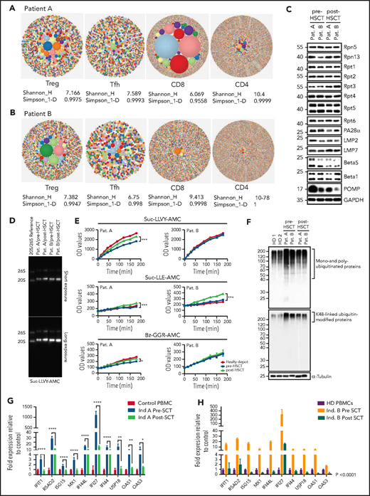 T-cell compartments, proteasome assembly, and function are restored posttransplant, enabling intracellular protein homeostasis and downregulation of the type-1 interferon response. (A-B) TCRb repertoire was determined by high-throughput sequencing of sorted T-cell subsets (T conventional, CD8+ T cells, Treg, T follicular helper cells). Representative hierarchical tree maps show TRB repertoire diversity in patients with truncating POMP mutations. Each dot represents a unique CDR-3, and the size of each dot corresponds to the frequency of that CDR-3 in the total population of sequences obtained. Shannon’s H entropy index measures the diversity of the repertoire, taking into account the clonal size distribution in the overall repertoire. Gini-Simpson index (Simpson_1-D) measures inequality of a given repertoire so that the lower the Simpson_1-D, the more unequal is the distribution of individual clonotypes in the sample results for patients A and B. (C) Whole-cell lysates from pre- and post-SCT peripheral blood mononuclear cell (PBMC) from PRAID patients A and B were separated by sodium dodecyl sulfate–polyacrylamide gel electrophoresis prior to western blotting using antibodies specific for various proteasome components and/or subunits, including USP14, Rpt1, Rpt2, Rpt3, Rpt4, Rpt5, Rpt6, PA28-α, β1i/LMP2/PSMB9, β5i/LMP7/PSMB10, β5/PSMB5, β1/PSMB6, and POMP, as indicated. Equal protein loading was ensured by probing the membrane with a monoclonal anti-GAPDH antibody. (D) PBMC derived from PRAID patients A and B before and after SCT were subjected to nondenaturing protein extraction to generate protein lysates, which were subsequently run on 3% to 12% native–polyacrylamide gel electrophoresis with proteasome bands being detected by their ability to cleave the Suc-LLVY-AMC fluorogenic peptide. Two exposure times are shown. (E) Protein lysates were tested for their chymotrypsin-, caspase-, and trypsin-like activities by incubating the samples with 0.1 mM of the Suc-LLVY-AMC, Suc-LLE-AMC, and Bz-GGR-AMC fluorogenic substrates, respectively. Fluorescence initiated by AMC release was measured every 15 minutes for the first 2 hours and every 30 minutes for the last 2 hours. Indicated on the y-axis are the raw fluorescence values. (F) Protein lysates derived from patients PBMC pre- and post-SCT were probed for the amounts of K-48–linked ubiquitinated proteins. (G-H) The expression of interferon type-I–inducible genes was evaluated in patient-derived PBMC pre- and posttransplant, and a subset of these was reevaluated posttransplant. The expression of all interferon type-I–regulated gene levels evaluated decreased posttransplant; results are expressed as fold change with respect to control gene expression. Results pretransplant are representative of 3 independent repeats with 3 replicates each. Results posttransplant are only representative of 2 independent repeats with 3 replicates each. Samples were compared using Student t test. Ind., individual; OD, optical density; Pat., patient; SCT, stem cell transplant.