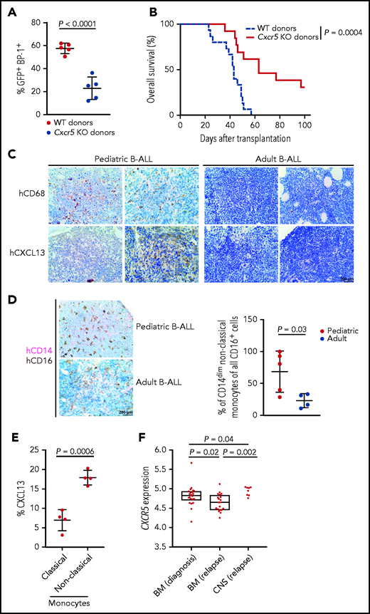 The CXCR5-CXCL13 axis may influence outcome in BCR-ABL1+ murine B-ALL and possibly human B-ALL. Percentage of GFP+ (BCR-ABL1+) BP-1+ cells in peripheral blood on day 27 after transplantation (P < .0001; Student t test, n = 5) (A) and Kaplan-Meier–style survival curve (B) for wild-type (WT) young recipients of 1 × 106 WT (blue) or Cxcr5 knockout (KO) (red) BCR-ABL1–transduced donor bone marrow (BM) cells in the B-ALL model. The difference in survival was statistically significant (P = .0004; log-rank test, n = 11-12). (C) Representative bone sections of 2 human pediatric (left) or adult (right) patients with B-ALL stained with antibodies to CD68 labeling macrophages or CXCL13. Scale bar, 200 μm. (D) Representative bone sections of human pediatric (top) or adult (bottom) patients with B-ALL stained with antibodies to CD14 (pink) and CD16 (brown), depicting CD14dim CD16+ nonclassic monocytes.21 The percentage of CD14dim CD16+ nonclassic monocytes of all CD16+ monocytes/natural killer cells per patient, as counted by a blinded pathologist, is shown on the right (P = .03; Student t test, n = 4-5) The scale bar depicts 200 μm. (E) Percentage of CXCL13+ CD14+ CD16dim (classic monocytes) vs CXCL13+ CD14dim CD16+ (nonclassic monocytes) in BM aspirates of human pediatric patients with B-ALL (P = .0006; Student t-test, n = 4). (F) Comparison of gene expression of CXCR5 on B-ALL blasts retrieved from bone marrow (BM) at diagnosis (n = 22), BM at relapse (n = 20), and the CNS (n = 8) (ie, blast cells retrieved from cerebrospinal fluid) at CNS relapse.37