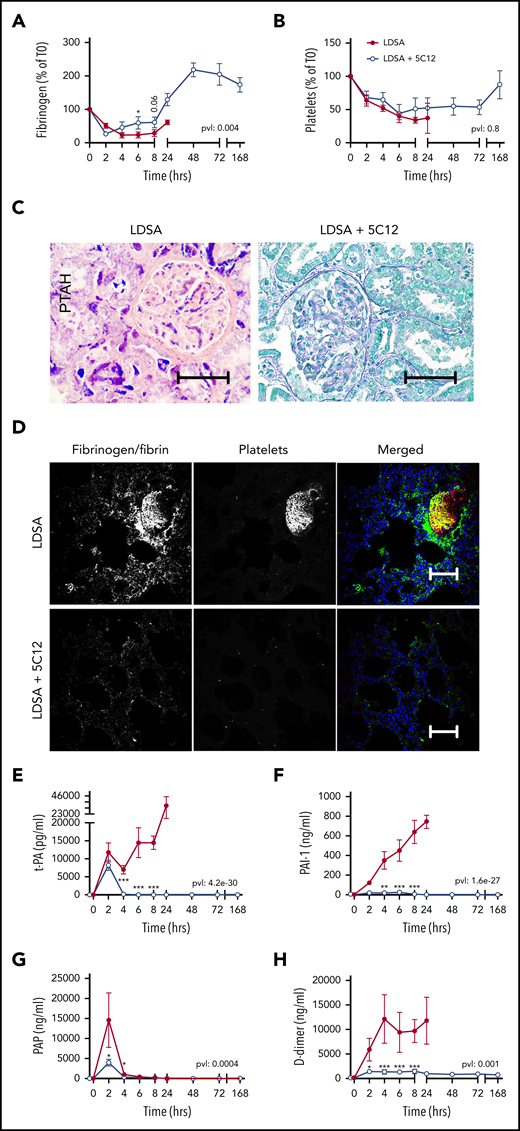Effect of 5C12 anti-FXII antibody on fibrinogen and platelet consumption, fibrin deposition in the tissues, and activation of fibrinolysis after challenge with a lethal dose of HI-SA (LDSA). (A-B) Time course dynamics of plasma fibrinogen (A) and platelet numbers (B). (C) Phosphotungstic acid–hematoxylin (PTAH) staining of kidney sections of animals challenged with LDSA, not treated (left) or treated with the 5C12 antibody (right). (D) Immunofluorescence staining for fibrin/fibrinogen (left) and platelet marker CD41 (middle) in the lung of baboons challenged with LDSA that were either not treated (top) or treated with the 5C12 antibody (bottom); merged color images are shown in the right panels. Nuclei were stained with To-PRO-3 (blue). Scale bars, 100 µm. Confocal images were acquired by using a Nikon Eclipse TE2000-U microscope equipped with a Nikon C1 scanning head; the Nikon EZ-C1 software (version 3.80) was used for image acquisition. (E-H) Time course changes of fibrinolysis markers in the plasma: t-PA (E), PAI-1 (F), plasmin-antiplasmin (PAP) complexes (G), and D-dimer (H). Same time points are compared between the treated and untreated baboons by using the generalized least squares (gls) function. *P < .05; ***P < .001. The overall P value (pvl) describing the difference between the 2 curves is shown on each graph. P < .05 is considered significant.