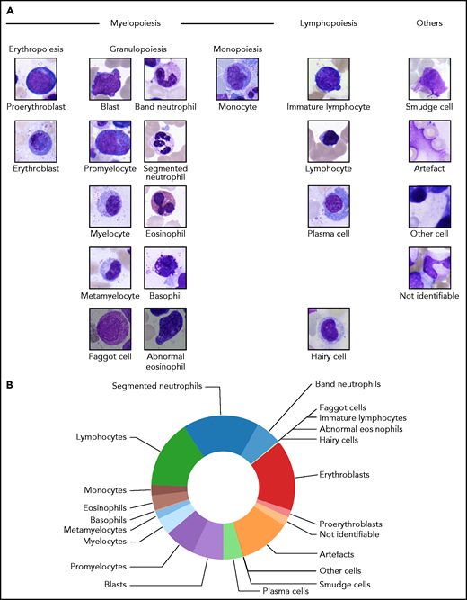 Structure of the 21 morphological classes of BM cells used in this study. (A) Ordering of the classes into hematopoietic lineages. In agreement with routine practice, major physiological classes of myelopoiesis and lymphopoiesis are included, as well as characteristic pathological classes and classes for artefacts and unclear objects. As detailed in the main text, all cells were stained using the May-Grünwald-Giemsa/Pappenheim stain, and imaged at ×40 magnification. (B) Distribution of the 171 374 nonoverlapping images of our data set into the classes used.