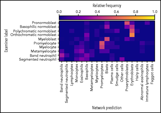The network exhibits fair performance on an external data set. Of 627 single-cell images from an external data set, the network predicted classes on 380 images (61% of the data set). The confusion matrix shows fair agreement between the annotations of Choi et al20 and the network predictions, which possess slightly different, but compatible, classification schemes. Good agreement is generally observed with the exception of confusions within the myeloid and erythroid lineages.