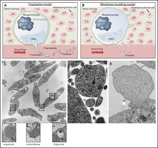 Schematic of current concepts of platelet production showing mature megakaryocytes localized close to bone marrow sinusoids. (A) Proplatelet model. Megakaryocytes polarize their demarcation membrane system (DMS) as prerequisite for directed release of long cytoplasmic protrusions called proplatelets, which are driven by reorganization of microtubules (shown in green) into the sinusoidal lumen. Platelet intermediates (preplatelets) and platelets are shed into the circulation by blood shear forces. The terminal stage of platelet production occurs in the bloodstream. (B) Membrane budding model. Continuous release of final platelets directly from the megakaryocyte via membrane budding. (C) Thin-section electron micrograph showing the hallmark features of blood platelets. Resting platelets have a discoid shape with clear α-granules (i), microtubules (ii), and dense granules (iii). (D) Electron micrograph showing a megakaryocyte membrane bud. Reproduced from Potts et al9 (© 2020 Potts et al) under a CC BY-NC-SA 4.0 license. (E) Electron micrograph showing a bleb from a cultured mouse megakaryocyte that lacks the characteristic features of an assembling platelet. Scale bar, 1 μm. Cells were fixed, processed, and imaged as previously described.10