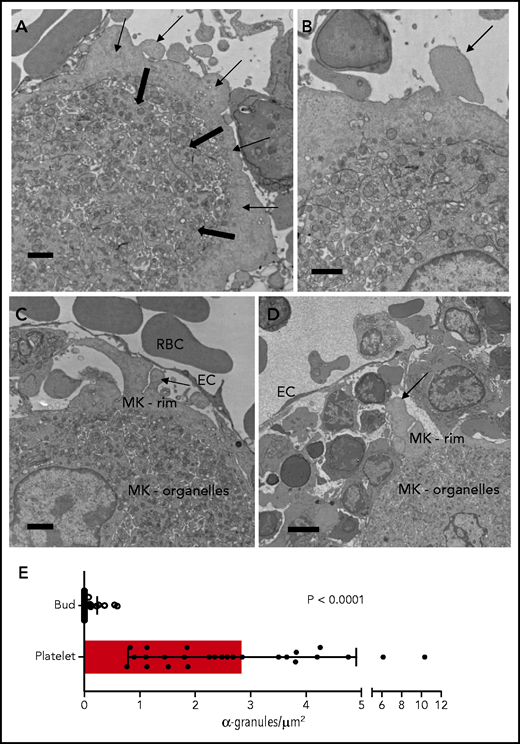 Thin-section electron micrographs showing blebbing megakaryocytes (MKs) in the bone marrow. (A) Bone marrow MKs demonstrate a central organelle-rich area (thick arrows) surrounded by an organelle-deplete cyoplasmic rim (thin arrows). (B) MK blebs lack the characteristic contents and features of an assembling platelet. (C-D) Blebbing MKs are frequently observed in the marrow adjacent to blood vessels. Scale bars, 2 μm. (E) Comparison of α-granule content in MK blebs vs mature platelets. TEM images of MK blebs (n = 32) and mature platelets (n = 26; supplemental Figure 2) were analyzed for α-granule number and total area; α-granule density (α-granule per μm2) is shown as mean ± standard deviation. EC, endothelial cell; RBC, red blood cell.