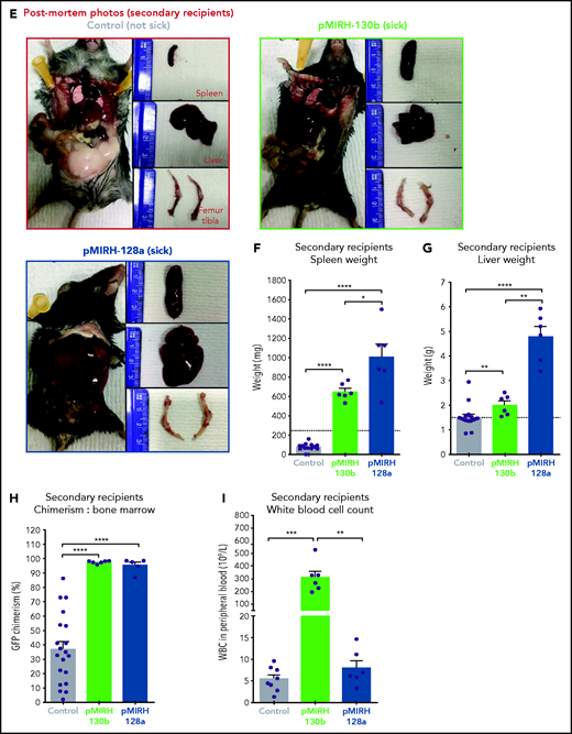 The overexpression of miR-130b and miR-128a in Mll-AF4+ FL LSK leads to a mixed/BCP/myeloid or lymphoblastic acute leukemia, respectively. (A) Experimental design. All mice received Mll-AF4–expressing cells. (B-C) Survival curve of primary, secondary, and tertiary recipients of the Mll-AF4+ pMIRH-130b (B) and Mll-AF4+ pMIRH-128a (C) cohorts. Total BM from 1 to 2 primary recipients was used for secondary transplants. Total BM from 2 to 3 recipients was used for tertiary transplants. Positive event = hematological malignancy linked to donor cells. A Gehan-Breslow-Wilcoxon test was used to compare survival curves. (D) Types of malignancies in Mll-AF4+ control, Mll-AF4+ pMIRH-130b, and Mll-AF4+ pMIRH-128a primary recipients. A χ2 test was used to compare the distribution of sick and non-sick mice. (E) Postmortem pictures of sick mice from the Mll-AF4+ control, Mll-AF4+ pMIRH-130b, and Mll-AF4+ pMIRH-128a cohorts. (F-G)) Spleen (F) and liver (G) weights. (H) GFP chimerism in the BM. (I) White blood cell (WBC) counts in Mll-AF4+ control and sick mice. (J-N) Proportion of myeloid cells (J), mixed lineage cells (K), B-lymphoid cells (L), c-Kit+ cells (M), and IgM+ and Il7r+ cells (N) in the GFP+ fraction of the BM of Mll-AF4+ control and sick mice (Mll-AF4+ pMIRH-130b or Mll-AF4+ pMIRH-128a). (O) Proportion of LSK Il7r+Flt3−, HSCs/MPPs (LSK Il7r− Flt3−), and LMPPs (LSK Flt3+) in the LSK compartment of control and sick mice. (P) CNS infiltration in Mll-AF4+ control, Mll-AF4+ pMIRH-130b, and Mll-AF4+ pMIRH-128a mice. The level of infiltration is described in “Methods.” (Q) Romanowsky staining of peripheral blood smears; scale bars, 20 μm. Data were compared using a Mann-Whitney U test. *P < .05; **P < .01; ***P < .001; ****P < .0001. Graphs are presented as mean ± standard error of the mean (1 dot = 1 mouse).