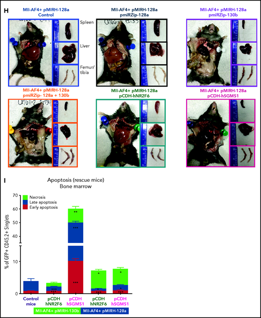 MiR-130b activity and NR2F6/SGMS1 inhibition is required for MLL-AF4+ leukemia maintenance. (A) Experimental layout of rescue experiment for Mll-AF4+ pMIRH-130b leukemic mice (18 000 GFP+ cells injected) and Mll-AF4+ pMIRH-128a leukemic mice (10 000 GFP+ cells injected). (B) Survival curve of Mll-AF4+ pMIRH-130b rescue mice (pmiRZip-scramble or pmiRZip-130b, NR2F6 or SGMS1 overexpression). (C) GFP chimerism in various organs of Mll-AF4+ pMIRH-130b rescue mice. (D) Lineage output in the GFP+ fraction of the BM of Mll-AF4+ pMIRH-130b rescue mice. (E) Survival curve of Mll-AF4+ pMIRH-128a rescue mice with miRNA inhibition (pmiRZip-scramble, pmiRZip-128a, pmiRZip-130b, or pmiRZip-128a+130b). (F) Survival curve of Mll-AF4+ pMIRH-128a rescue mice with NR2F6 or SGMS1 overexpression. A statistical comparison of the survival rate of rescue mice was performed using a χ2 test to compare the distribution of sick and non-sick mice (indicated next to the number of sick mice/total mice). (G) GFP chimerism in the BM of Mll-AF4+ pMIRH-128a rescue mice. (H) Postmortem photos of representative Mll-AF4+ pMIRH-128a rescue mice. (I) Apoptosis/necrosis of fresh GFP+ cells retrieved from the BM of Mll-AF4+ pMIRH-130b and Mll-AF4+ pMIRH-128a rescue mice upon NR2F6 or SGMS1 overexpression. Recipients of SGMS1-overexpressing cells were euthanized because of a stroke-like phenotype. Data were compared using a Mann-Whitney U test: *P < .05; **P < .01; ***P < .001. A Gehan-Breslow-Wilcoxon test was used to compare survival curves. Graphs are presented as mean ± standard error of the mean (1 dot = 1 mouse). PB, peripheral blood.