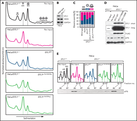 Nonsynonymous variants in EFL1 disrupt 80S assembly with varying severity. (A) Polysome profiling results of EFL1+/+ and EFL1−/− cells followed by transfection of vectors containing EFL1WT, EFL1p.Thr1069Ala, or EFL1p.His30Arg (as indicated in the top right corner of each plot). Note the different heights of 60S and 80S peaks in each experiment (dotted lines). (B) Immunoblot showing the CRISPR knockout of EFL1 in HeLa cells. (C) Quantification of the polysome profiling results displaying the relative occupancy of different ribosome statuses. Each bar corresponds to each experiment in panel B. (D) Immunoblots of EFL1 and eIF6 in wild-type or EFL1−/− HeLa cells with or without transfection of vectors containing EFL1WT, EFL1p.Thr1069Ala, or EFL1p.His30Arg. (E) Immunoblots of eIF6 from ribosomal fractions that best represent 60S and 80S of HeLa cells; each corresponds to the polysome profiles shown above. GAPDH, glyceraldehyde-3-phosphate dehydrogenase.