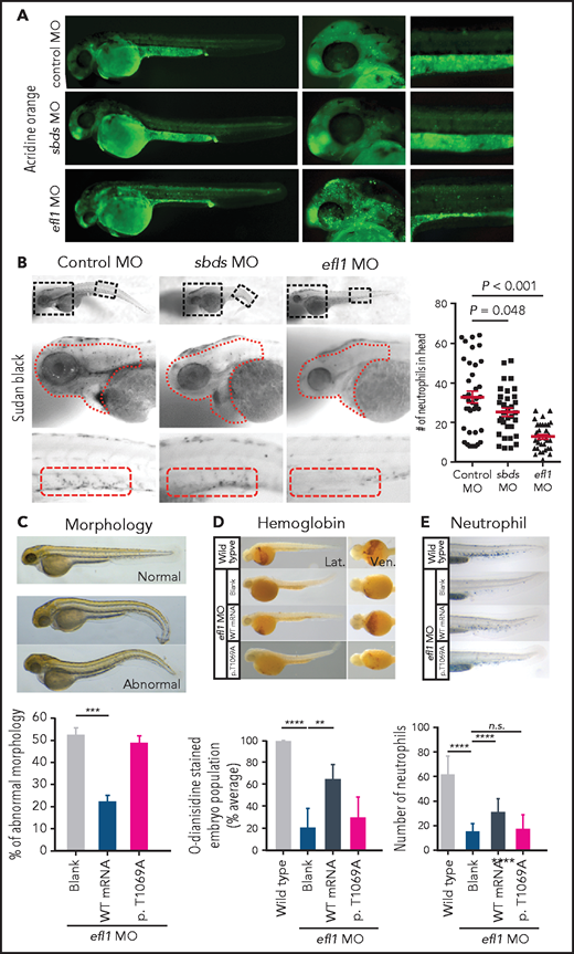 Zebrafish efl1 morphants model human SDS features. (A-B) Cell death (A) and neutrophil production (B) of zebrafish embryos 48 hours post fertilization by the knockdown of efl1 and sbds. (C-E) Rescue of efl1 MO animals using human EFL1WT or EFL1p.Thr1069Ala RNA, documenting morphology (C), hemoglobin production (D), and neutrophil production (E). **P < .01, ***P < .0005, ****P < .0001. MO, morpholino; n.s., not significant; WT, wild type.