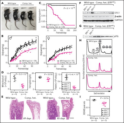 Mouse Efl1 mutants model human SDS features. (A) Body sizes of the CH mice (Efl1m/−) at 3 weeks compared with the wild-type littermates. (B) Body weight curves of the CH animals compared with the wild-type animals. Males (left) and females (right) are plotted separately. (C) Survival plot. (D) Hematopoietic features of the CH animals, measured at postnatal days 35-42. (E) Hematoxylin and eosin staining of the bone marrow from 69- and 85-day-old femurs. (F) Level of EFL1 protein in wild-type or CH livers. (G) Immunoblots of eIF6 from wild-type or CH livers. (H) Polysome profiling results of wild-type or CH mouse livers. (I) Quantification of the polysome profiling results. Scale bars, 1 cm (A); 0.5 mm (E).