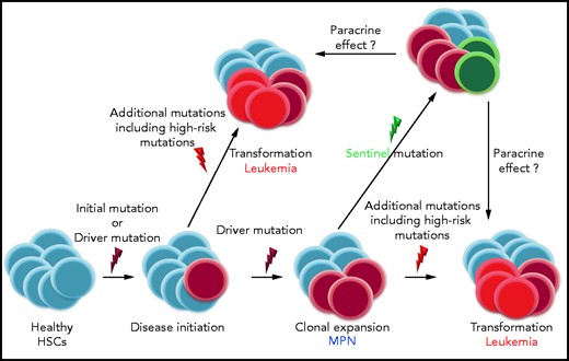 Mechanism of action of the different types of oncogenic mutations in myeloid diseases: “initial mutations” may precede “driver mutations,” which are disease initiating. In MPN, JAK2V617F, CALR, and MPL mutations are recognized as “drivers.” During disease course, additional mutations are incurred; some of these may constitute “high-risk mutations,” for example, ASXL1, EZH2, SRSF2, and IDH1/2, which promote leukemic transformation. Marcault and colleagues describe a novel type of mutation, “sentinel mutations,” the acquisition of which drastically increases the likelihood of leukemic transformation, even though in some patients the mutation does not occur in the cells that form the leukemic clone. The authors suggest that paracrine mechanisms may contribute to leukemic transformation in patients with MPN. It appears that mutations in the same genes, for example, NFE2, can act either as “sentinels” or as “high-risk mutations.” HSCs, hematopoietic stem cells.