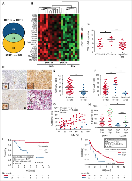 CD70 overexpression in nodal MCLs. (A) Venn diagram showing the overlap between the NanoString-based statistically significant upregulated genes in SOX11+ compared with SOX11− nodal MCLs (50 genes; blue circle) and SOX11+ compared with RLNs (54 genes; yellow circle). (B) Heatmap showing the scaled expression levels of common 24 significant upregulated genes in SOX11+ compared with SOX11− nodal MCLs and RLNs. Red represents increased expression and green reduced expression. Genes with an adjusted P value (Q-value) < .15 were considered. (C) CD70 mRNA expression levels in unpurified lymph node MCL samples (unpurified LN; n = 34), CD19+ purified cells from LN samples (CD19+ LN; n = 4) and peripheral blood samples (CD19+ PB; n = 15) (GSE70910). *q value < .05, ***q value < .001. (D) Representative histological sections from (i) an RLN sample, (ii) SOX11+, and (iii) SOX11− nodal MCL biopsy, stained with specific anti-human CD70 antibody (×100). A double IHC staining with anti-human CD70 (brown) and (iv) anti-human cyclin D1 (red) antibodies (×100) was performed in the same SOX11− nodal MCL case as in (iii) to confirm the expression of CD70 by tumor cells (black arrows). Pictures contain insets with magnification (×400). (E) IHC quantifications of CD70+ cells in our series of SOX11+ (n = 51) and SOX11− (n = 13) nodal MCL primary samples. (F) IHC quantification of CD70 expression in nodal samples according to classic, blastoid/pleomorphic, or small cell MCL variants. (G) Positive correlation between CD70+ and Ki67+ cells, quantified by IHC in our series of nodal MCL. SOX11+ MCL are indicated in red, whereas SOX11− MCLs are in blue. Graphs show Pearson correlation coefficient (r), P value, and number of cases analyzed (N). (H) IHC quantification of CD70 expression in nodal MCL samples according to high (Ki67 >30%) and low (Ki67 ≤30%) proliferation rates in our series of SOX11+ (red) and SOX11− (blue) primary MCL cases. MCL cases diagnosed as blastoid/pleomorphic cytological variant are highlighted in green. The significance of differences was determined by independent samples Student t test: *P < .05, **P < .01, ***P < .001. (I) Kaplan-Meier curve and Cox regression showing the association of CD70+ cells, quantified by IHC using our series of SOX11+ nodal MCL primary samples (n = 40), with OS. (J) Kaplan-Meier curve and Cox regression showing the association of CD70 mRNA expression with OS, using previously published GEP from nodal samples and clinical data from 122 nodal SOX11+ MCL primary cases (GSE93291). High values were defined by Maxstat (cutoff point IHC = 25%, cutoff point mRNA = 9.9). Log-rank test P values, hazard ratios (HR) with 95% confidence interval (CI), and Cox regression P values are shown.