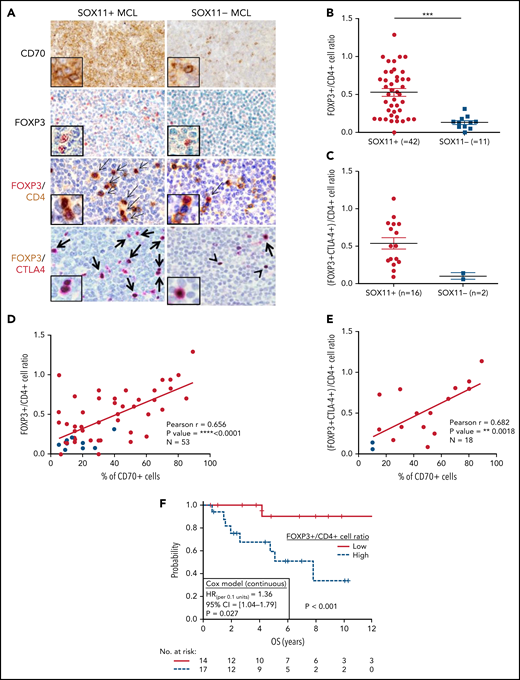 High number of intratumoral Treg CELLS correlates with high numbers of CD70+ cells in SOX11+ nodal MCLs, and it is associated with shorter OS of MCL patients. (A) Representative histological sections from SOX11+ and SOX11− nodal MCL primary sample stained with specific anti-human CD70 and FOXP3 antibodies (×100) and with double IHC staining with anti-FOXP3 (red) and CD4 (brown); and FOXP3 (brown) and CTLA-4 (red) (×200), insets (×400). Double-positive cells are marked by black arrows, whereas single-positive cells are marked by a black arrowhead. (B) IHC quantification of FOXP3+/CD4+ T-cell ratio in SOX11+ and SOX11− nodal MCLs. (C) IHC quantifications of (FOXP3+CTLA4+)/CD4+ T-cell ratio in SOX11+ and SOX11− nodal MCLs. (D-E) Positive correlation between CD70+ cells and FOXP3+/CD4+ T-cell ratio (D) and CD70+ cells and (FOXP3+CTLA4+)/CD4+ T-cell ratio (E) in SOX11+ (red) and SOX11− (blue) nodal MCLs, quantified by IHC in our series of nodal MCL (E). Graphs show Pearson correlation coefficient (r), P value, and number of cases analyzed (N). (F) Kaplan-Meier curve and Cox regression showing the association of FOXP3+/CD4+ cell ratio, quantified by IHC in our series of SOX11+ nodal MCL, with OS. High values were defined by Maxstat (cutoff point = 0.40). Log-rank test P value, hazard ratio (HR) with 95% confidence interval (CI), and Cox regression P value are shown.