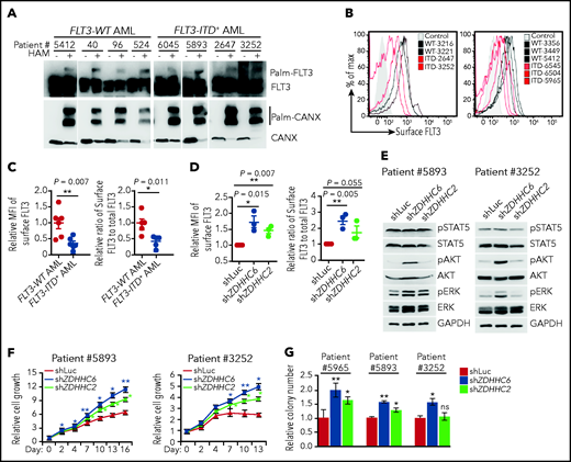 ZDHHC6-mediated palmitoylation restrains FLT3-ITD surface expression, signaling and colonogenic growth in primary human AMLs. (A) Examination of FLT3 palmitoylation in primary FLT3-WT and FLT3-ITD+ AML cells by the APE assay. (B) Flow cytometric plots showing cell surface FLT3 expression of various FLT3-WT (black traces) vs FLT3-ITD+ (red traces) primary AMLs. Control (shaded area) indicates secondary antibody only. (C) The quantification of the MFIs of surface FLT3 levels in FLT3-ITD+ AMLs (left; n = 5) relative to that in FLT3-WT AMLs (n = 6), as shown in panel B. Relative surface/total FLT3 level in FLT3-ITD+ AMLs (right) when compared with FLT3-WT AMLs. The total FLT3 levels were determined by flow cytometry after fixation and permeabilization of AML cells. (D) Quantification of the MFIs of surface FLT3 level (left) and relative surface-to-total FLT3 level (right) in FLT3-ITD+ AML cells depleted of ZDHHC2 or ZDHHC6 when compared with that of Luc control (n = 3 for each group). (E) WB analysis of signaling transduction in 2 FLT3-ITD+ patient AML cells depleted of ZDHHC2 or ZDHHC6 vs Luc. (F) Cell growth of FLT3-ITD+ patient AML cells upon depletion of ZDHHC2 or ZDHHC6 as in panel D. (G) Relative colony-forming capacity of 3 individual FLT3-ITD+ patient AML cells with depletion of ZDHHC2 or ZDHHC6 vs Luc. All relevant data are presented as means ± standard deviation. (C-D) Each symbol represents individual patient AML cells. (F-G) Data analyses were performed in triplicate. In all relevant panels, *P < .05; **P < .01; ns, not significant, as determined by 2-tailed Student t test.