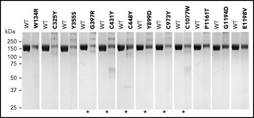 Variants showing weak FH bands under nonreducing SDS-PAGE. Coomassie-stained gels showing each FH variant compared with equal amounts of wild-type (WT) FH protein (measured as optical density at absorbance at 280 nm). Asterisks indicate FH variants that were previously described to be associated with no-expression alleles or decreased FH plasma levels (see supplemental Table 3). Differences in expression levels were confirmed in all cases by enzyme-linked immunosorbent assay measurements.