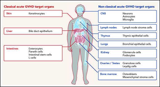 Classical (red) and nonclassical (blue) acute GVHD manifestations are shown. The typical GVHD target cell types that are primarily damaged by the alloreactive immune response are indicated. Additional cell types may be targets of aGVHD but further experimental evidence for their involvement is needed.