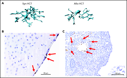 Microglia activation and T cell infiltration in nonclassical GVHD target organs. (A) Representative images showing Imaris-based (Bitplane) 3D reconstruction of Iba-1+ microglia cells from BALB/c mice on day 14 after syn-HCT or allo-HCT as indicated. (B) Histology of brain samples immunostained for CD3+ T cells (brown) from BALB/c mice on day 14 after allo-HCT. The arrows point toward CD3+ T cells. Scale bar, 50 μm. (C) Nonirradiated B6D2F1 mice were injected with 3 × 107 purified EGFP++ T cells and 5 × 107 wild-type B6 T cell–depleted bone marrow. The ovaries were analyzed on day +14. EGFP-positive (brown) donor T cells infiltrate in the ovarian follicles beyond the basement membrane. Scale bar, 100 μm.