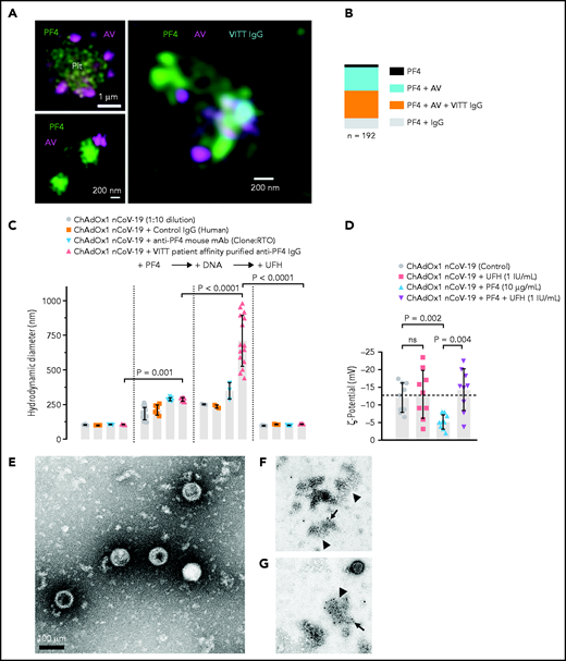 Complex formation of PF4, vaccine components, and anti-PF4 antibodies on platelet surfaces. (A) 3D super-resolution microscopy of PF4, AV and affinity-purified anti-PF4 antibodies (obtained from VITT patients) reveals complex formation. Upper left panel: PF4 (green) and AV hexon protein (purple) accumulation on platelet surfaces. Scale bar, 1 µm. Lower left panel: Localization microscopy (dSTORM) of PF4 (green) at ChAdOx1 vaccine aggregates (AV, purple). Scale bar, 200 nm. Right panel: colocalization of ChAdOx1 AV hexon protein (AV; purple), PF4 (green) and purified anti-PF4 IgG from VITT patient sera (blue). Scale bar, 200 nm. (B) Relative composition of 192 complexes analyzed. Approximately 44.5% of complexes investigated showed VITT anti-PF4 IgG bound to particles containing both PF4 and AV hexon proteins. (C) Analyses of ChAdOx1 nCoV-19 vaccine by DLS. Diameter of ChAdOx1 nCoV-19 vaccine aggregates before (left) and after addition of PF4 (+PF4, 10 µg/ml). Incubation of mouse anti-P F4 recombinant antibody (clone RTO) or purified anti-PF4 IgG from VITT patients increased the size of vaccine aggregates in the presence of PF4. Addition of DNA further increased the size of PF4/vaccine aggregates (+DNA). In contrast, addition of heparin (100 IU/mL) dissociated previously formed vaccine/PF4/anti-PF4 IgG complexes. Each data point represents 12 runs of n ≥3 individual measurements. Statistical assessment by ordinary 1-way analysis of variance (ANOVA) with Sidak's multiple comparisons test. (D) Negative charge indicated by surface ζ potential (ζ,13 mV) of ChAdOx1 nCoV-19 vaccine particles in the presence of buffer (control), UFH (1 IU/mL), PF4 (reduced the negative charge; −5 mV), and coapplication of PF4 and heparin. Statistical assessment by Brown-Forsythe and Welch ANOVA test followed by Dunnett's T3 multiple comparisons test. Transmission electron microscopy images of aggregates formed in the vaccine upon addition of PF4. (E) Vaccine without added PF4 shows the virion particles and multiple small amorphous structures. (F) Aggregate (arrowhead) formation in the vaccine following addition of PF4. Biotinylated PF4 (arrow) is labeled with 10 nm gold particles. (G) Aggregate (arrowhead) as in panel F. Here, AV capsid protein (arrow) is labeled with 10 nm gold particles. Scale bars, 100 nm.