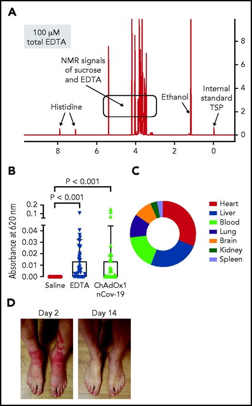 ChAdOx1 nCoV-19 vaccine contains EDTA and induces inflammatory reactions in mouse edema models and vaccinated individuals. (A) 1H-NMR spectrum of ChAdOx1 nCoV-19 vaccine showed signals of sucrose, ethanol, histidine, and EDTA (∼100 µM). X-axis: NMR chemical shift signals in ppm relative to internal standard TSP; y-axis: relative signal intensity. (B) Skin edema in wild-type mice was induced by intradermal injection of 50 μL each saline, EDTA (100 μM), or ChAdOx1 nCoV-19. Evans blue dye was intravenously infused as a tracer, and after 30 minutes extravasated dye was quantified. Columns show mean ± SD, n = 41 per group. Paired 1-way ANOVA followed by Dunn’s multiple comparison test. (C) Digital PCR quantified AV DNA 30 minutes after intradermal injection of 50 μL ChAdOx1 nCoV-19 in wild-type mice. Segments give relative percentage in multiple organs of disseminated ChAdOx1 nCoV-19 AV copy numbers; n = 3 individual experiments. (D) Skin reaction 2 days after ChAdOx1 nCov-19 vaccination and following symptom resolution on day 14. D-Dimer was elevated at 4 and 6 days following ChAdOx1 nCoV-19 vaccination, with symptom resolution in following days.