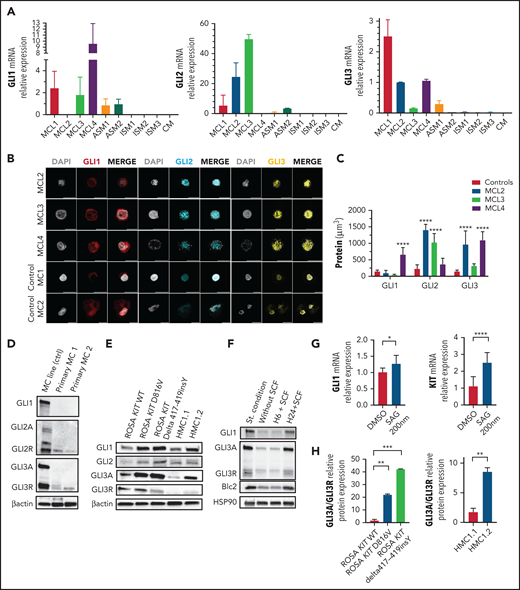 The Hh signaling pathway is active in MC lines and in primary MCs from patients with MCL. (A) Relative gene expression of GLI1, GLI2, and GLI3 in WBM from patients with KIT A502_Y503dup MCL (MCL1), KIT WT MCL (MCL2), KIT D816V MCL (MCL3), KIT S501_A502dup MCL (MCL4), KIT D816V ASM (ASM1), or KIT WT ASM (ASM2) and from 3 patients with KIT D816V ISM (ISM1-3) and from 1 patient with KIT D816V CM (CM). (B) Immunofluorescence analysis of primary MCs from patients with MCL2, MCL3, or MCL4 and from 2 healthy controls. Note the increase of GLI1 or GLI2 and GLI3 in patients with MCL compared with healthy controls. (C) Quantification of GLI1, GLI2, and GLI3 expression in all patients. (D) Immunoblots with protein extracts from cord blood–derived MCs (Primary MC1 and MC2) and ROSA KIT D816V, stained with GLI1, GLI12, and GLI13 antibodies. (E) Immunoblots of ROSA and HMC1 cell lines stained with GLI1, GLI12, and GLI13 antibodies. (F) Immunoblots of ROSA KIT WT cells cultured in different conditions: standard, without (−) or with (+) SCF, and stained with GLI1, GLI3, and Bcl2. (G) Relative gene expression of GLI1 and KIT in HMC1.2 stimulated with SAG. (H) Relative quantification of GLI3A/GLI3R ratio. *P < .05, **P < .01, ***P < .001, ****P < .0001. PC, proteolytic cleavage domain; TA, transactivation domains; ZNF, zinc finger domain.
