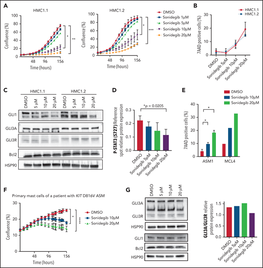 The Hh pathway is essential for MC transformation. (A) Time course of the proliferation of HMC1.1 and HMC1.2 cell lines treated with increasing concentrations of sonidegib or DMSO. Cell confluence was measured by using live-cell imaging (IncuCyte). HMC1 proliferation (percentage confluence) is plotted against time (in hours). (B) Death of HMC1.1 and HMC1.2 cells treated with increasing concentrations of sonidegib or DMSO. (C) Immunoblots of HMC1.2 and HMC1.1 cells treated in the same conditions and stained with GLI1, GLI3, and Bcl2 antibodies. (D) Quantification of P-STAT3 in treated HMC1.2 cells by using a phosphokinase array. (E) Time-course of proliferation of primary MCs obtained from a patient with KIT D816V ASM treated with increasing concentrations of sonidegib or DMSO. (F) Death of primary MCs of a patient with KIT D816V ASM (ASM1) and of a patient with KIT S501_A502dup MCL (MCL4) treated with increasing concentrations of sonidegib or DMSO. (G) Immunoblots of the same patient’s primary MCs treated in the same conditions, stained with GLI3, GLI1, and Bcl2; the corresponding quantification of GLI3A/GLI3R relative protein expression is indicated. Data are from 3 independent experiments. *P < .05; **P < .01; ***P < .001; ****P < .0001.